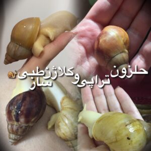 واگذاری واگزاری حلزون طبی فوری
